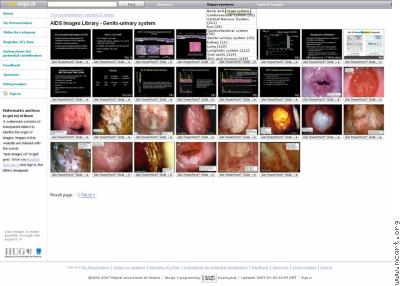 The AIDS Images Library